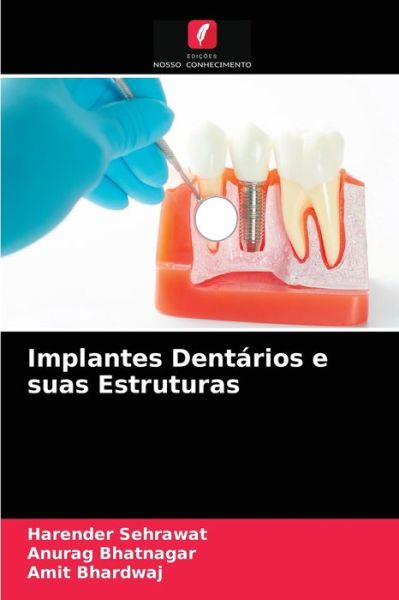 Cover for Harender Sehrawat · Implantes Dentarios e suas Estruturas (Paperback Book) (2021)