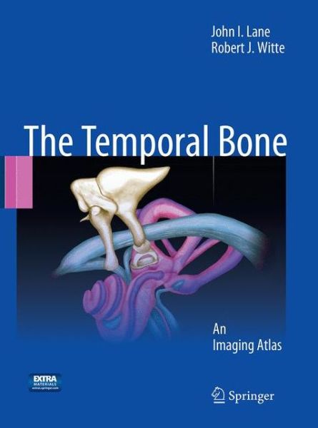 Cover for Lane · Temporal Bone (Book) [Softcover reprint of the original 1st ed. 2010 edition] (2017)