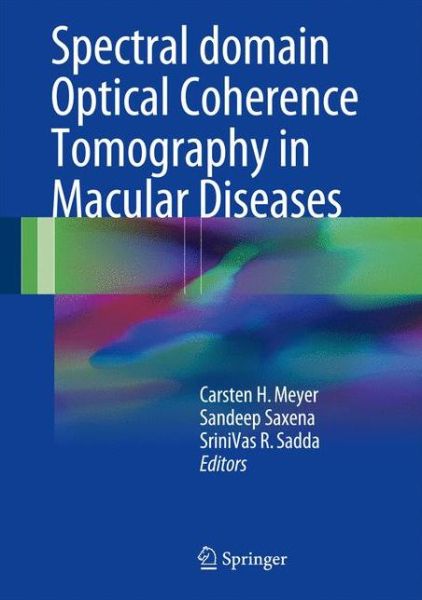 Cover for Spectral Domain Optical Coherence Tomography in Macular Diseases (Hardcover Book) [1st ed. 2016 edition] (2016)