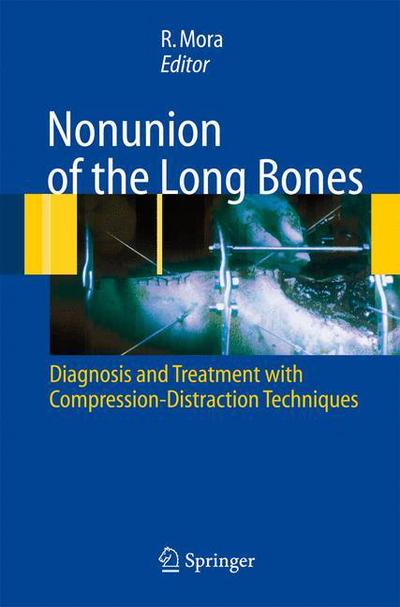 Cover for Nonunion of the Long Bones: Diagnosis and treatment with compression-distraction techniques (Hardcover Book) [2006 edition] (2006)