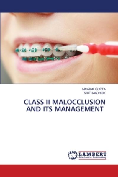 Cover for Mayank Gupta · Class II Malocclusion and Its Management (Paperback Book) (2021)