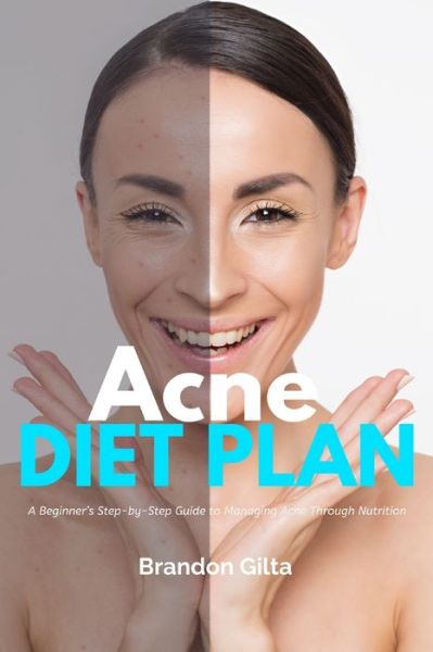 Cover for Brandon Gilta · Acne Diet Plan (Paperback Book) (2020)