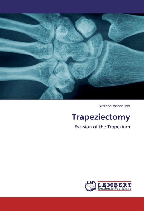 Cover for Iyer · Trapeziectomy (Book)