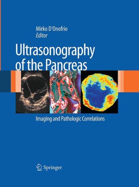 Ultrasonography of the Pancreas: Imaging and Pathologic Correlations - - Books - Springer Verlag - 9788847039087 - August 23, 2016