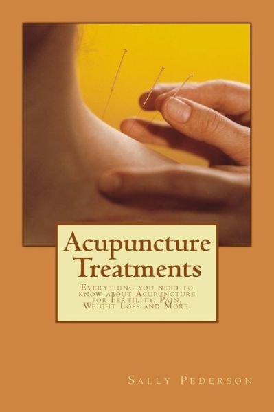 Cover for Sally Pederson · Acupuncture Treatments: Everything You Need to Know About Acupuncture for Fertility, Pain, Weight Loss and More. (Paperback Book) (2012)
