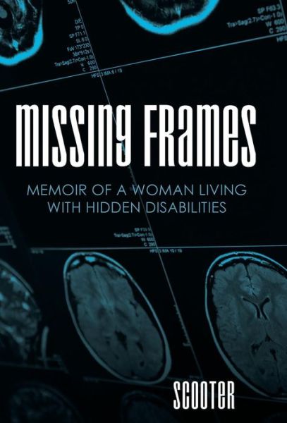 Missing Frames: Memoir of a Woman Living with Hidden Disabilities - Scooter - Livros - iUniverse - 9781491756089 - 18 de junho de 2015