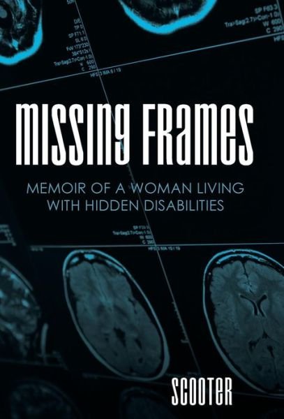 Cover for Scooter · Missing Frames: Memoir of a Woman Living with Hidden Disabilities (Hardcover bog) (2015)