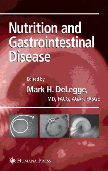 Cover for Mark H Delegge · Nutrition and Gastrointestinal Disease - Clinical Gastroenterology (Hardcover Book) [2008 edition] (2007)