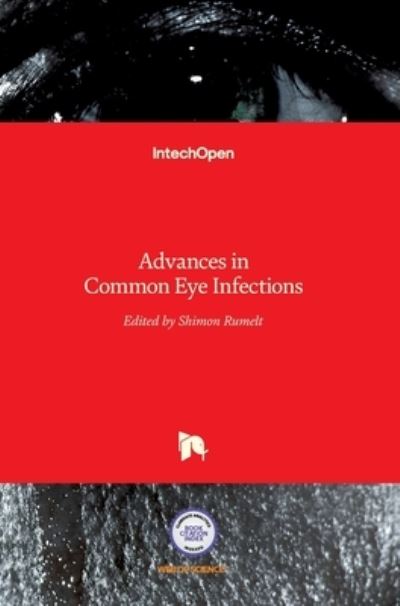 Cover for Shimon Rumelt · Advances in Common Eye Infections (Hardcover Book) (2016)