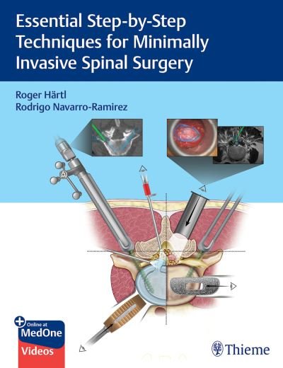 Cover for Roger Hartl · Essential Step-by-Step Techniques for Minimally Invasive Spinal Surgery (Innbunden bok) (2022)
