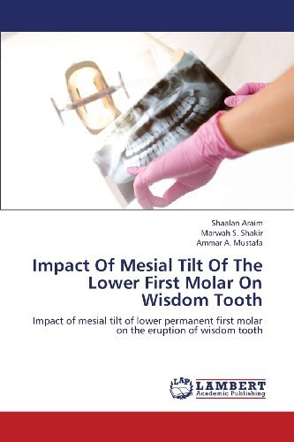 Cover for Ammar A. Mustafa · Impact of Mesial Tilt of the  Lower First Molar on Wisdom Tooth: Impact of Mesial Tilt of Lower Permanent First Molar on the Eruption of Wisdom Tooth (Paperback Book) (2013)