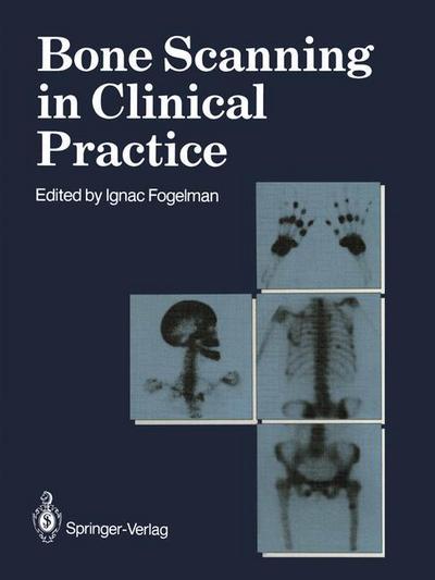 Cover for Ignac Fogelman · Bone Scanning in Clinical Practice (Paperback Bog) [Softcover reprint of the original 1st ed. 1987 edition] (2012)