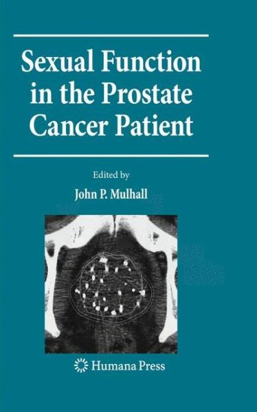 Cover for Sexual Function in the Prostate Cancer Patient - Current Clinical Urology (Paperback Book) [Softcover reprint of hardcover 1st ed. 2009 edition] (2010)