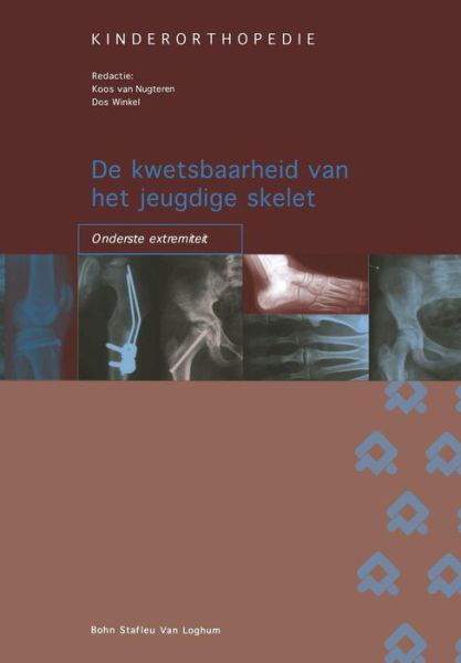 Kinderorthopedie: De Kwetsbaarheid Van Het Jeugdige Skelet: Onderste Extremiteit - Bsl Fictief - Bøker - Bohn Stafleu Van Loghum - 9789031344093 - 1. juli 2004