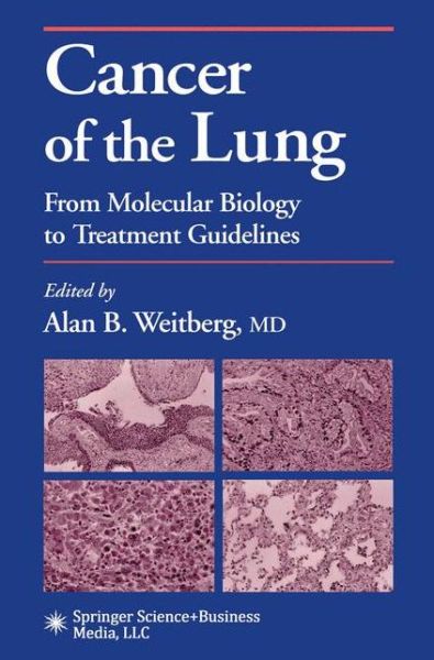 Cover for Alan B Weitberg · Cancer of the Lung: From Molecular Biology to Treatment Guidelines - Current Clinical Oncology (Paperback Book) [1st ed. Softcover of orig. ed. 2002 edition] (2010)