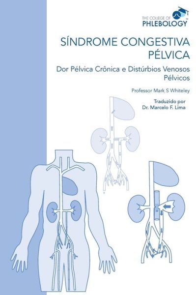 Cover for Mark S Whiteley · SINDROME CONGESTIVA PELVICA Dor Pelvica Cronica e Disturbios Venosos Pelvicos (Paperback Book) (2021)