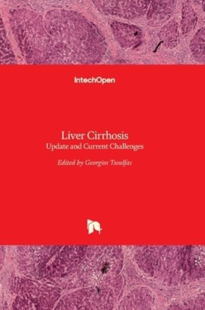 Cover for Georgios Tsoulfas · Liver Cirrhosis: Update and Current Challenges (Hardcover Book) (2017)