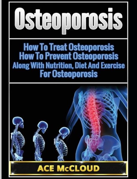 Cover for Ace McCloud · Osteoporosis (Innbunden bok) (2017)