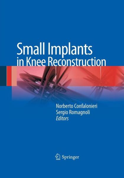 Cover for Small Implants in Knee Reconstruction (Paperback Book) [Softcover reprint of the original 1st ed. 2013 edition] (2016)