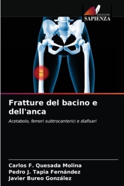 Cover for Carlos F Quesada Molina · Fratture del bacino e dell'anca (Paperback Book) (2021)
