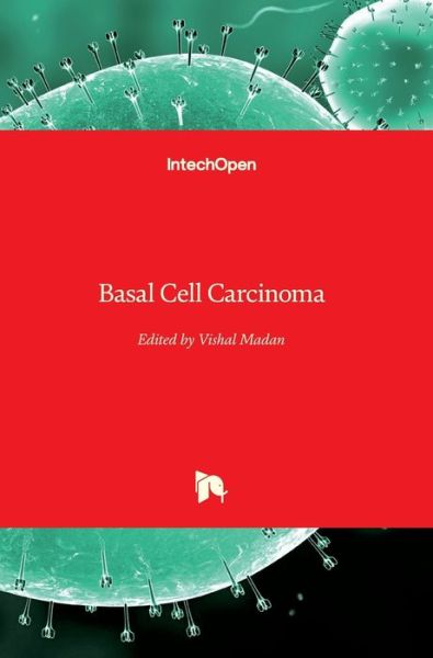 Cover for Vishal Madan · Basal Cell Carcinoma (Hardcover Book) (2012)