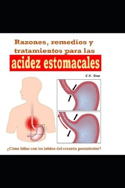 Razones, remedios y tratamientos para las acidez estomacales: ?Como lidiar con los latidos del corazon persistentes? - C X Cruz - Books - Independently Published - 9798538094097 - July 15, 2021