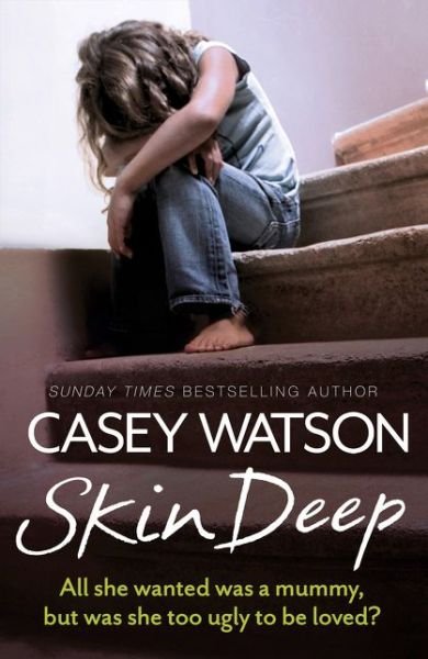 Cover for Casey Watson · Skin Deep: All She Wanted Was a Mummy, but Was She Too Ugly to be Loved? (Paperback Book) (2015)