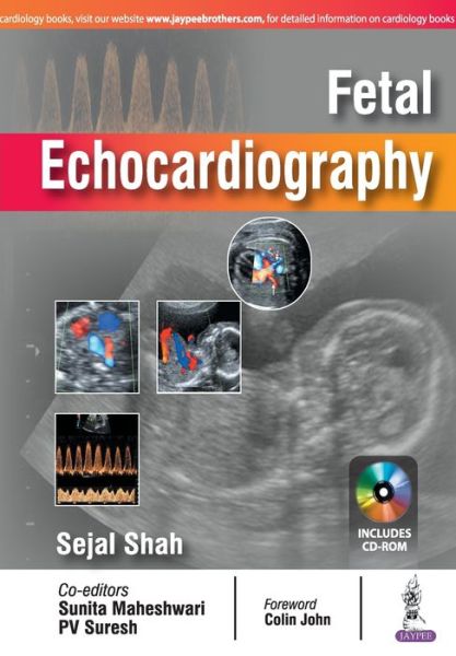 Cover for Sejal Shah · Fetal Echocardiography (Taschenbuch) (2017)