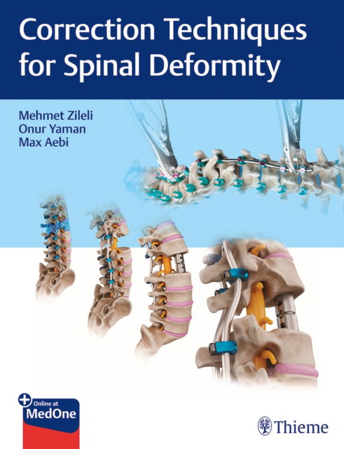 Correction Techniques for Spinal Deformity -  - Other - Thieme Publishers Delhi - 9789395390101 - October 14, 2024