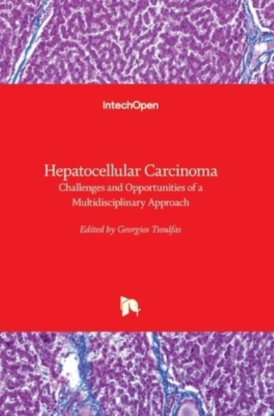 Georgios Tsoulfas · Hepatocellular Carcinoma: Challenges and Opportunities of a Multidisciplinary Approach (Hardcover Book) (2022)