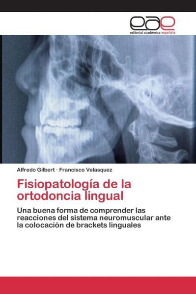 Cover for Gilbert Alfredo · Fisiopatologia De La Ortodoncia Lingual (Paperback Book) (2015)