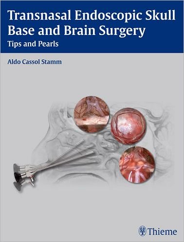 Cover for Aldo C. Stamm · Transnasal Endoscopic Skull Base and Brain Surgery : Tips and Pearls (Indbundet Bog) (2011)