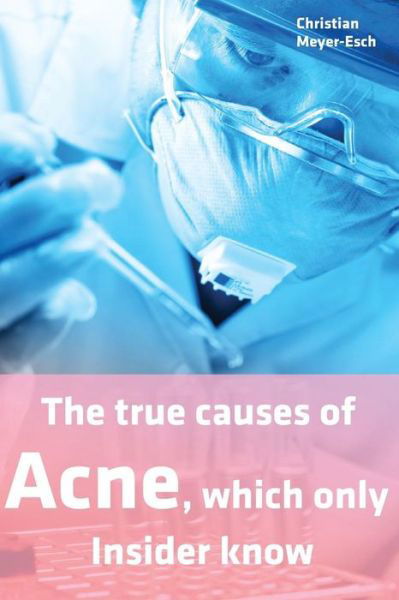 Cover for Christian Meyer-Esch · The true causes of Acne, which only Insider know (Paperback Bog) (2017)