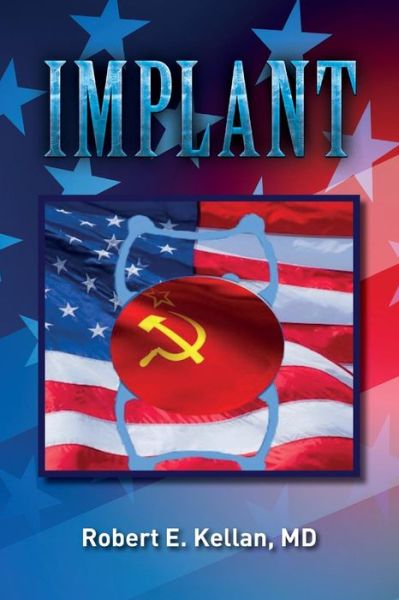 Cover for MD Robert E Kellan · Implant (Paperback Book) (2018)