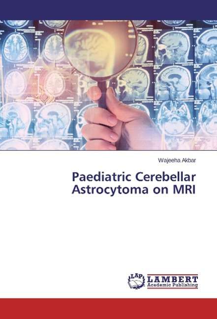 Cover for Akbar · Paediatric Cerebellar Astrocytoma (Book)