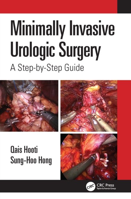 Cover for Qais Hooti · Minimally Invasive Urologic Surgery: A Step-by-Step Guide (Paperback Book) (2022)