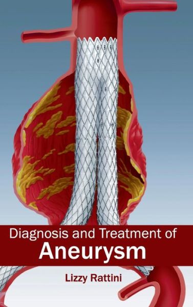 Cover for Lizzy Rattini · Diagnosis and Treatment of Aneurysm (Hardcover Book) (2015)