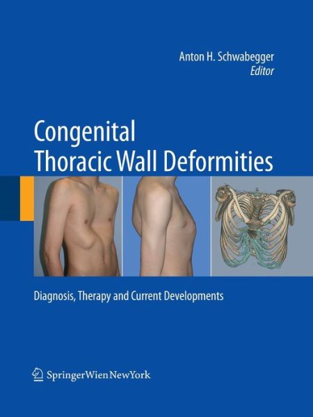 Cover for Congenital Thoracic Wall Deformities: Diagnosis, Therapy and Current Developments (Paperback Book) [Softcover Reprint of the Original 1st 2011 edition] (2016)