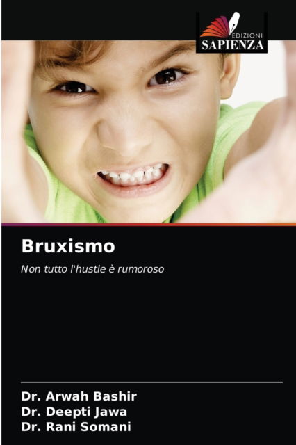 Bruxismo - Dr Arwah Bashir - Livros - Edizioni Sapienza - 9786203618105 - 26 de abril de 2021