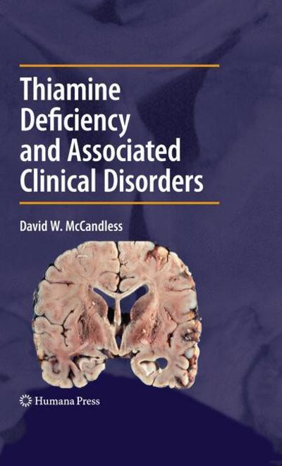 Cover for David W. Mccandless · Thiamine Deficiency and Associated Clinical Disorders - Contemporary Clinical Neuroscience (Hardcover Book) (2009)