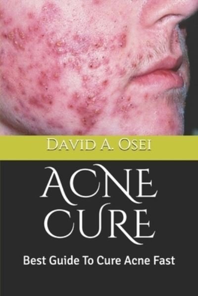 Cover for David a Osei · Acne Cure (Paperback Book) (2019)