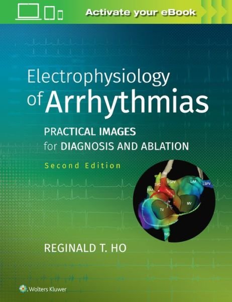 Cover for Reginald T. Ho · Electrophysiology of Arrhythmias: Practical Images for Diagnosis and Ablation (Inbunden Bok) (2019)