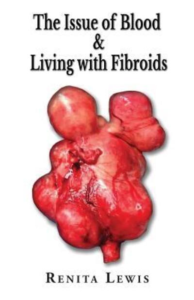 Cover for Renita Lewis · The Issue Of Blood &amp; Living with Fibroids (Paperback Book) (2016)