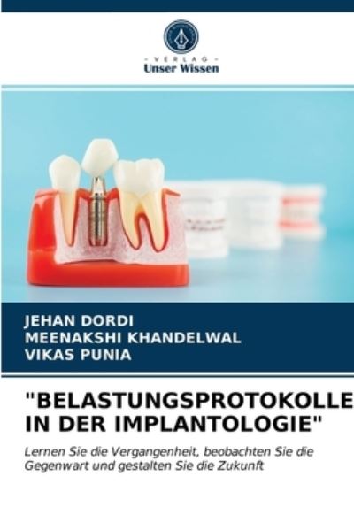 Cover for Jehan Dordi · Belastungsprotokolle in Der Implantologie (Paperback Book) (2021)