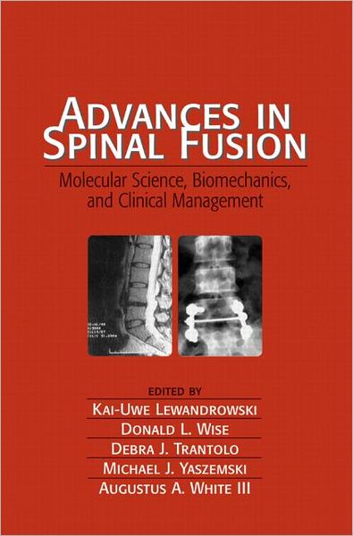 Cover for Kai-Uwe Lewandrowski · Advances in Spinal Fusion: Molecular Science, BioMechanics, and Clinical Management (Hardcover Book) (2003)