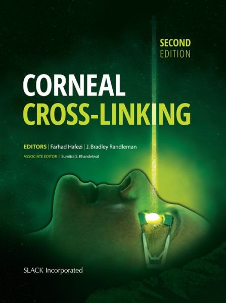 Corneal Cross-Linking - Farhad Hafezi - Books - SLACK  Incorporated - 9781630912109 - April 15, 2017