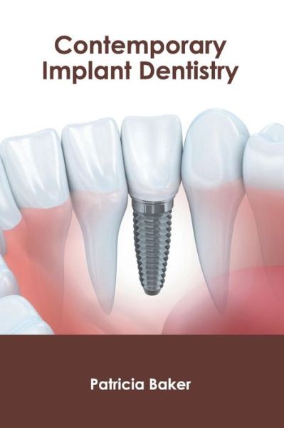 Cover for Patricia Baker · Contemporary Implant Dentistry (Hardcover Book) (2019)