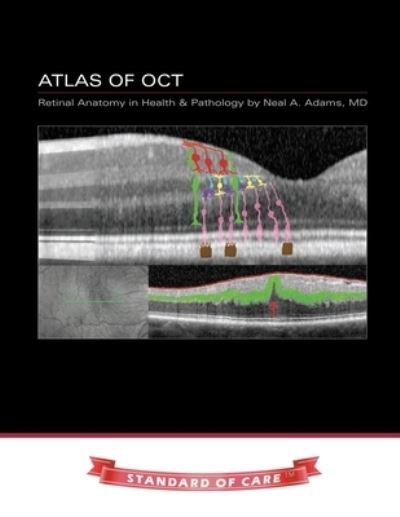 Atlas of OCT - Neal Adams - Bøger - INDEPENDENTLY PUBLISHED - 9781687062109 - 30. september 2014