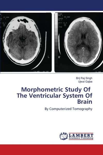 Cover for Singh · Morphometric Study Of The Ventric (Book) (2020)