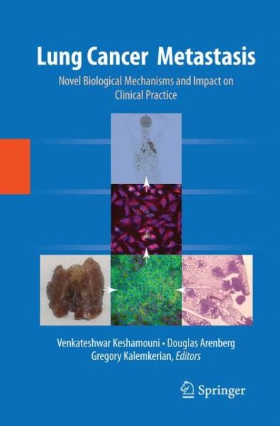 Cover for Venkateshwar Keshamouni · Lung Cancer Metastasis: Novel Biological Mechanisms and Impact on Clinical Practice (Paperback Book) [2010 edition] (2014)